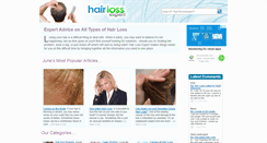 Desktop Screenshot of hairlossexpert.co.uk
